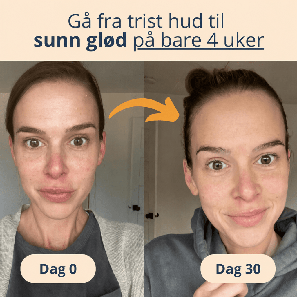 LED Lysterapi Ansiktsmaske - AVABeauty.no